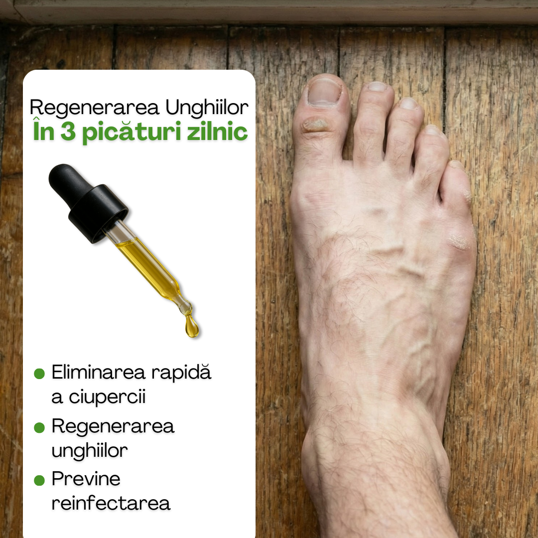 Ulei Fungic - Naturvia®️