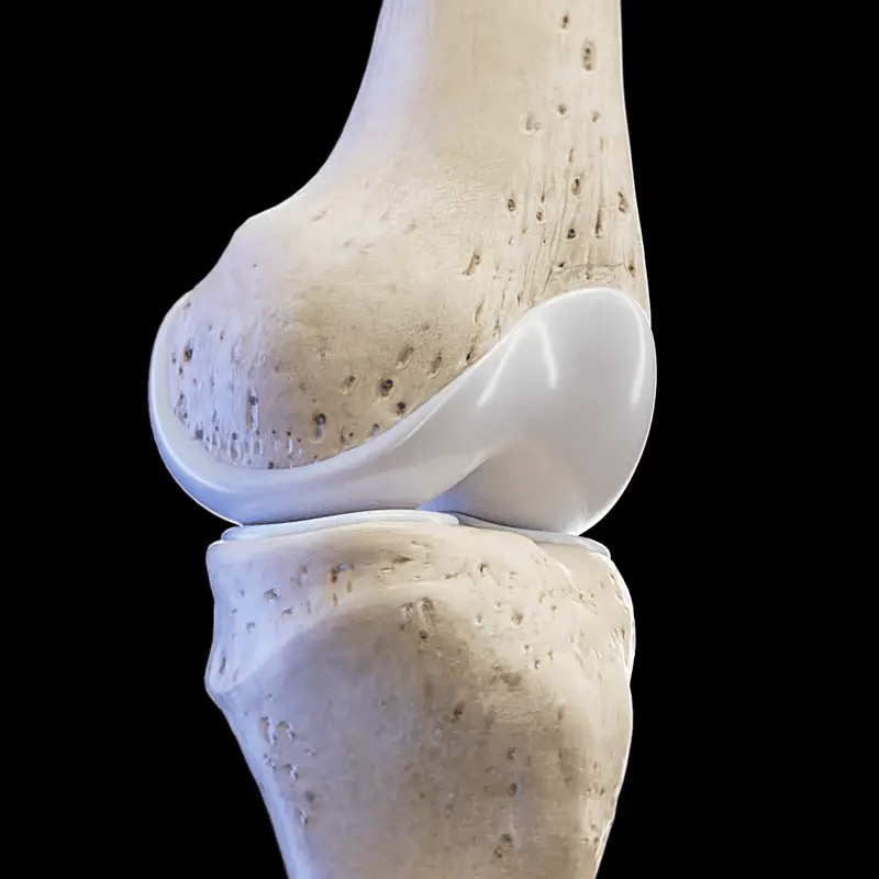 Causa del dolor articular